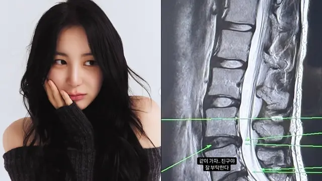 Lee Chae Yeon